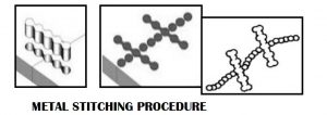 Metal Stitching/Metal Locking Procedure